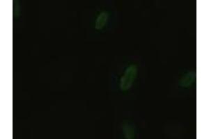 Anti-BFGF mouse monoclonal antibody (ABIN2452354) immunofluorescent staining of HeLa cells transiently transfected by pCMV6-ENTRY BFGF (RC217426) (FGF2 抗体  (AA 10-155))