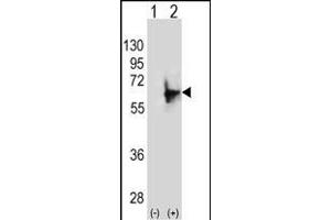 Western blot analysis of NMT2 (arrow) using rabbit polyclonal NMT2 Antibody (E31) (ABIN389095 and ABIN2839287). (NMT2 抗体  (N-Term))