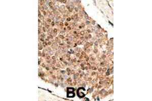 Immunohistochemistry (IHC) image for anti-Bone Morphogenetic Protein 10 (BMP10) antibody (ABIN5018806) (BMP10 抗体)
