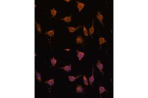 Immunofluorescence analysis of L929 cells using V antibody  at dilution of 1:100. (VAV3 抗体  (AA 560-680))