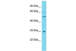 Host:  Rabbit  Target Name:  Camk4  Sample Type:  Mouse Testis lysates  Antibody Dilution:  1. (CAMK4 抗体  (C-Term))