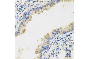 Immunohistochemistry of paraffin-embedded mouse lung using CXCL8 antibody (ABIN3172524) at dilution of 1/100 (40x lens). (IL-8 抗体)