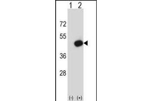 Western blot analysis of Pdk2 (arrow) using rabbit polyclonal Mouse Pdk2 Antibody (N-term) (ABIN657996 and ABIN2846942). (PDK2 抗体  (N-Term))