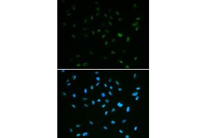 Immunofluorescence analysis of A549 cell using MSH6 antibody. (MSH6 抗体)