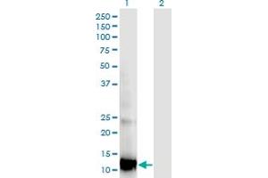Western Blot analysis of RBP5 expression in transfected 293T cell line by RBP5 monoclonal antibody (M05), clone 2D1.