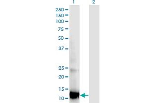 Retinol Binding Protein 5 抗体  (AA 1-135)