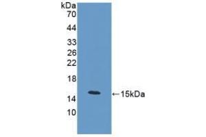 Detection of Recombinant PCT, Mouse using Polyclonal Antibody to Procalcitonin (PCT) (Procalcitonin 抗体  (AA 26-136))