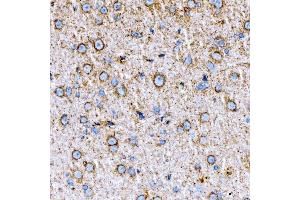 IHC analysis of RAB7/RAB7A using anti-RAB7/RAB7A antibody (ABIN7600597). (RAB7A 抗体  (AA 21-177))