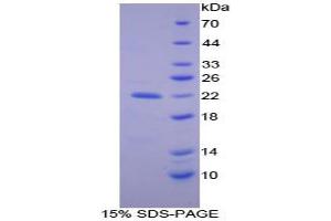 SDS-PAGE analysis of Human Apolipoprotein B Protein. (APOB 蛋白)