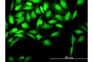 Immunofluorescence of monoclonal antibody to CKS2 on HeLa cell. (CKS2 抗体  (AA 1-79))