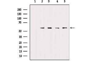 Western blot analysis of extracts from various samples, using SOX9 Antibody. (SOX9 抗体)