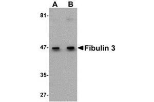 Western blot analysis of Fibulin 3 in HeLa cell lysate with AP30337PU-N Fibulin 3 antibody at (A) 0. (FBLN3 抗体  (C-Term))