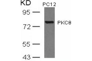 Image no. 3 for anti-Protein Kinase C, theta (PRKCQ) (AA 674-678) antibody (ABIN197566) (PKC theta 抗体  (AA 674-678))