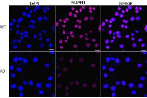 anti-BCL2-Like 2 (BCL2L2) antibody