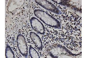 Immunostaining (ISt) image for anti-RAB GTPase Activating Protein 1-Like (RABGAP1L) (AA 1-110) antibody (ABIN523296)