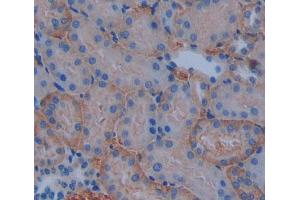 Immunohistochemistry (IHC) image for anti-ATP-Binding Cassette, Sub-Family B (MDR/TAP), Member 10 (ABCB10) (AA 457-715) antibody (ABIN5013180)