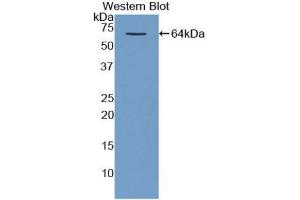 Detection of Recombinant MBP, Human using Polyclonal Antibody to Major Basic Protein (MBP) (Major Basic Protein 抗体  (AA 105-222))