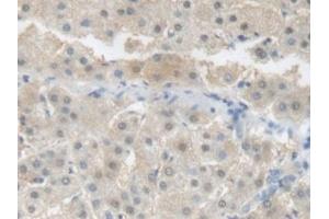 Detection of CRP in Human Liver Tissue using Polyclonal Antibody to C Reactive Protein (CRP) (CRP 抗体  (AA 17-224))