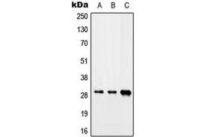 Western blot analysis of CIP29 expression in Jurkat (A), mouse heart (B), rat liver (C) whole cell lysates. (SARNP 抗体  (C-Term))