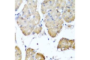 Immunohistochemistry of paraffin-embedded human stomach using NIN antibody (ABIN6129422, ABIN6144630, ABIN6144632 and ABIN6224239) at dilution of 1:100 (40x lens). (Ninein 抗体  (AA 1-287))