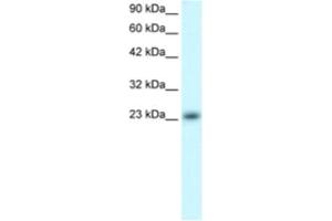 Western Blotting (WB) image for anti-MAX Dimerization Protein 4 (MXD4) antibody (ABIN2460569) (MXD4 抗体)
