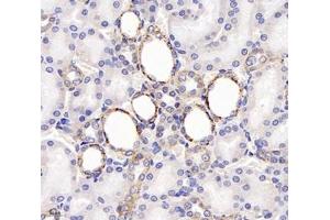 Immunohistochemistry (Paraffin-embedded Sections) (IHC (p)) image for anti-Tetraspanin 1 (TSPAN1) antibody (ABIN7075867)