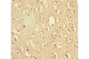 Immunohistochemistry of paraffin-embedded human brain tissue using ABIN7164380 at dilution of 1:100 (DHX35 抗体  (AA 1-300))