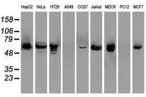 Image no. 3 for anti-Checkpoint Kinase 2 (CHEK2) antibody (ABIN1497500) (CHEK2 抗体)