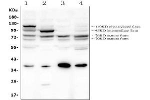 anti-Glucosidase, Alpha, Acid (GAA) (AA 494-527), (Middle Region) antibody