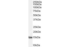 Image no. 1 for anti-Ribosomal Protein S19 (RPS19) (Internal Region) antibody (ABIN374632) (RPS19 抗体  (Internal Region))