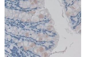 Detection of IL1F9 in Mouse Colon Tissue using Monoclonal Antibody to Interleukin 1 Family, Member 9 (IL1F9) (IL1F9 抗体  (AA 5-149))