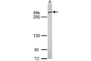 Fatty Acid Synthase 抗体  (N-Term)