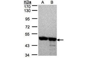 AP31121PU-N ANXA7 antibody staining of 293T (Lane A), A431 (B) whole cell lysates (30 µg) at 1/2000 dilution, 7. (Annexin VII 抗体  (AA 122-419))