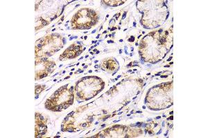 Immunohistochemistry of paraffin-embedded human colon using RPN1 antibody at dilution of 1:100 (x40 lens). (RPN1 抗体)