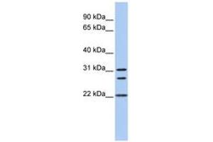 Image no. 1 for anti-Calponin (N-Term) antibody (ABIN6743468) (Calponin 抗体  (N-Term))