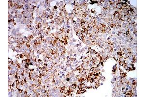 Immunohistochemistry (IHC) image for anti-Toll-Like Receptor 9 (TLR9) (AA 868-1016) antibody (ABIN5542492)