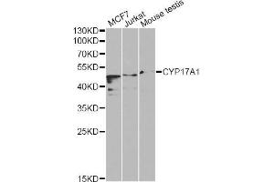 Western blot analysis of extracts of various cell lines, using CYP17A1 Antibody (ABIN5970640) at 1/1000 dilution. (CYP17A1 抗体)