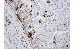 Image no. 2 for anti-Sex Determining Region Y (SRY) antibody (ABIN1501140) (SRY 抗体)