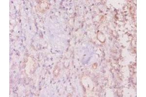 Immunohistochemistry of paraffin-embedded human kidney tissue using ABIN7160281 at dilution of 1:20 (MUC16 抗体  (AA 14067-14328))