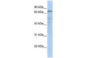 GMPS antibody used at 1 ug/ml to detect target protein. (GMP Synthase 抗体  (Middle Region))