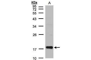 WB Image Sample(30 μg of whole cell lysate) A:Raji , 12% SDS PAGE antibody diluted at 1:1000 (Cofilin 2 抗体  (C-Term))