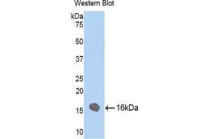 Detection of Recombinant FABP4, Human using Polyclonal Antibody to Fatty Acid Binding Protein 4 (FABP4) (FABP4 抗体  (AA 2-132))