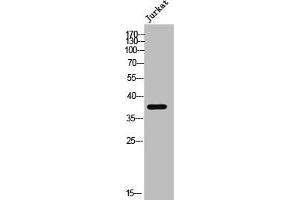 Western Blot analysis of Jurkat cells using EDG-2 Polyclonal Antibody (LPAR1 抗体  (N-Term))