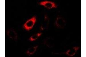 Immunofluorescent analysis of HPPDase staining in U2OS cells. (HPD 抗体)