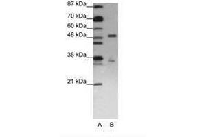 Image no. 2 for anti-UPF3 Regulator of Nonsense Transcripts Homolog B (UPF3B) (N-Term) antibody (ABIN203166) (UPF3B 抗体  (N-Term))