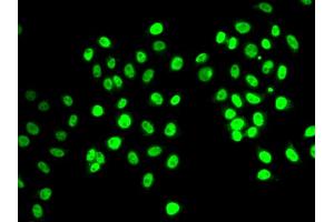 Immunofluorescence analysis of MCF-7 cells using REST antibody.