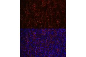 Immunofluorescence (IF) image for anti-Fc Fragment of IgE, Low Affinity II, Receptor For (CD23) (FCER2) antibody (ABIN7267160)
