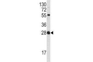 Western Blotting (WB) image for anti-Fibroblast Growth Factor 18 (FGF18) antibody (ABIN3002728) (FGF18 抗体)