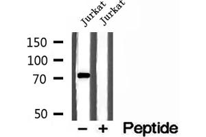 Western blot analysis of extracts of Jurkat cells, using MTO1 antibody. (MTO1 抗体  (N-Term))