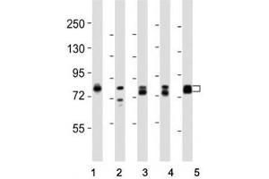 Western blot testing of DNM1L antibody at 1:8000 dilution and lysate from: 1: rat PC12 (Dynamin 1-Like 抗体  (C-Term))